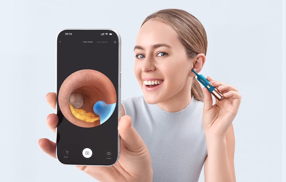 Μια γυναίκα κρατά ένα smartphone με καθαρή εικόνα του εσωτερικού του αυτιού, χρησιμοποιώντας μια συσκευή Bebird με μπλε άκρο